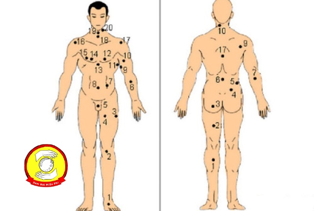 Những vị trí nốt ruồi đặc biệt trên cơ thể nam giới